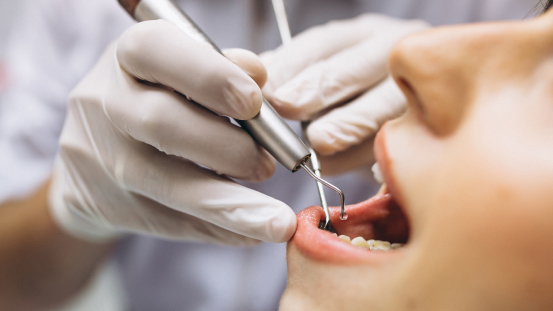 endodoncia dental