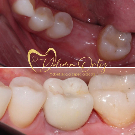 periodoncia e implantología oral