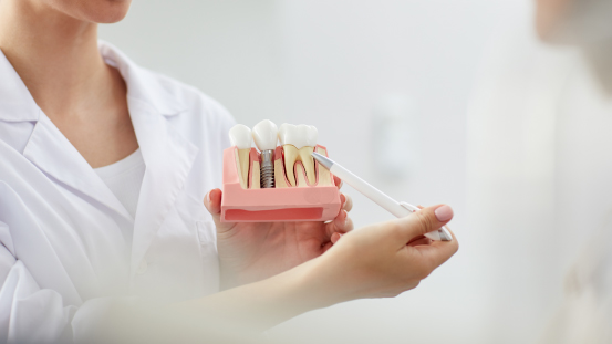 periodoncia e implantología oral