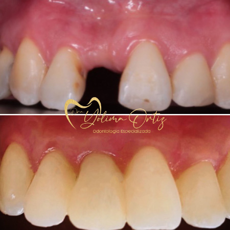 periodoncia e implantología oral