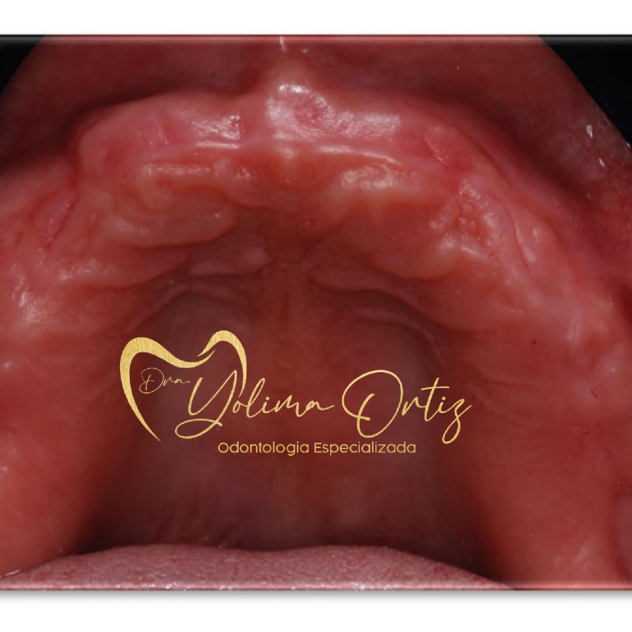 PERIODONCIA E IMPLANTOLOGÍA ORAL