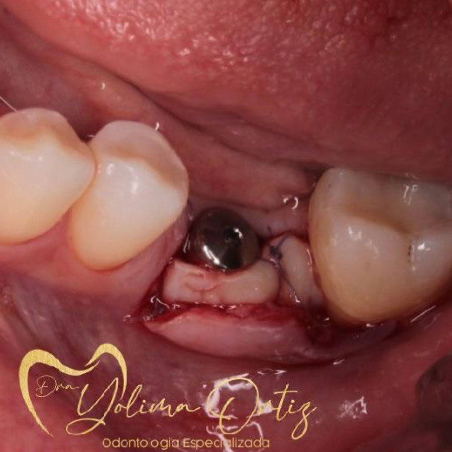 periodoncia e implantología oral