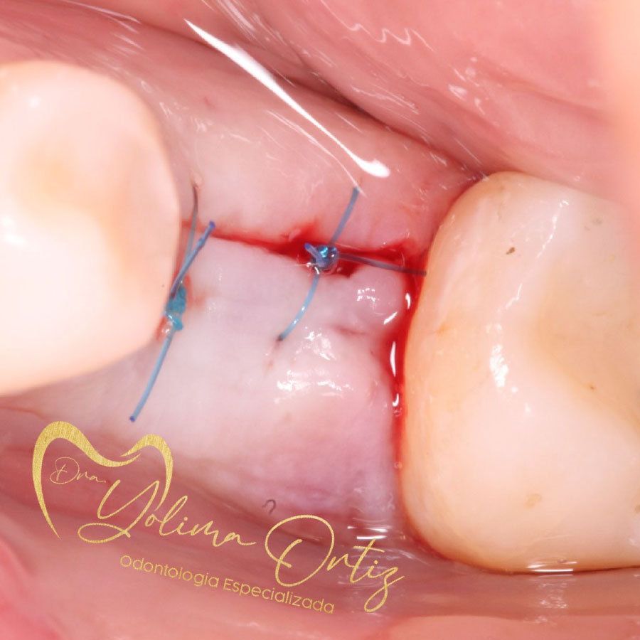 periodoncia e implantología oral