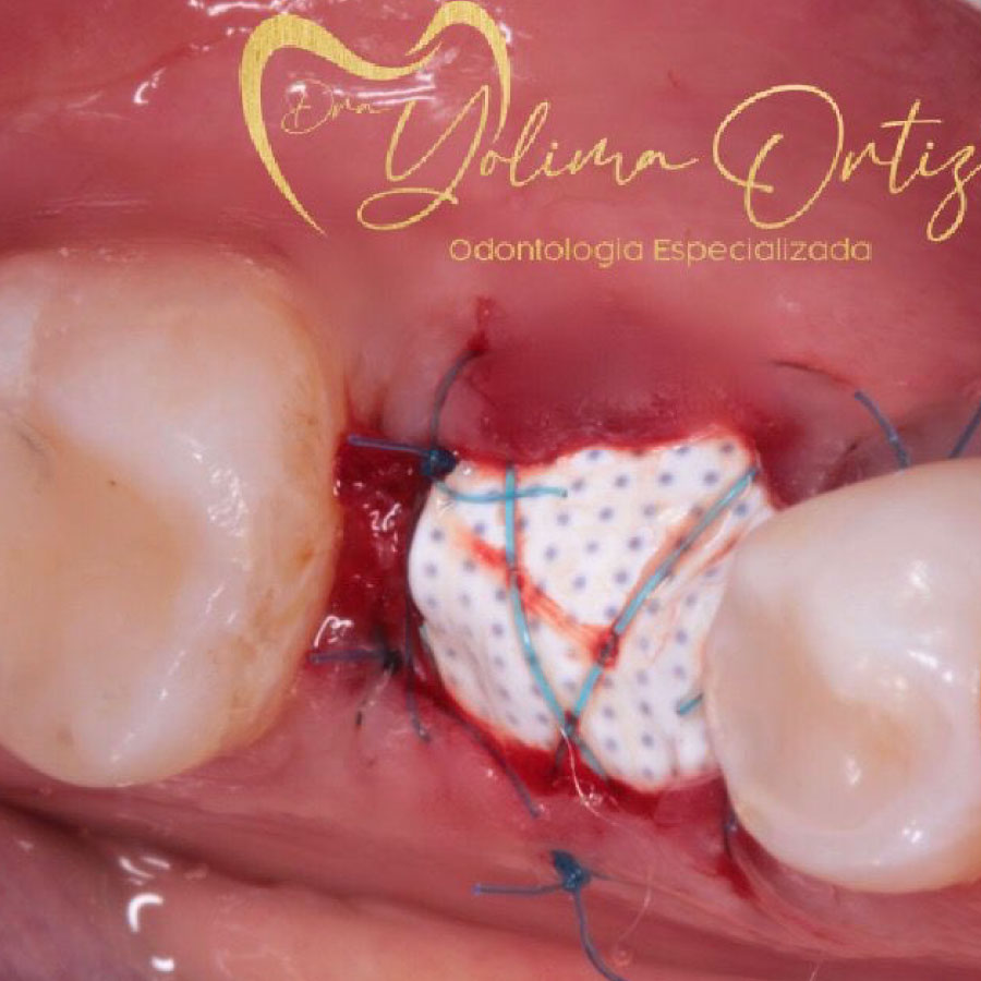 periodoncia e implantología oral