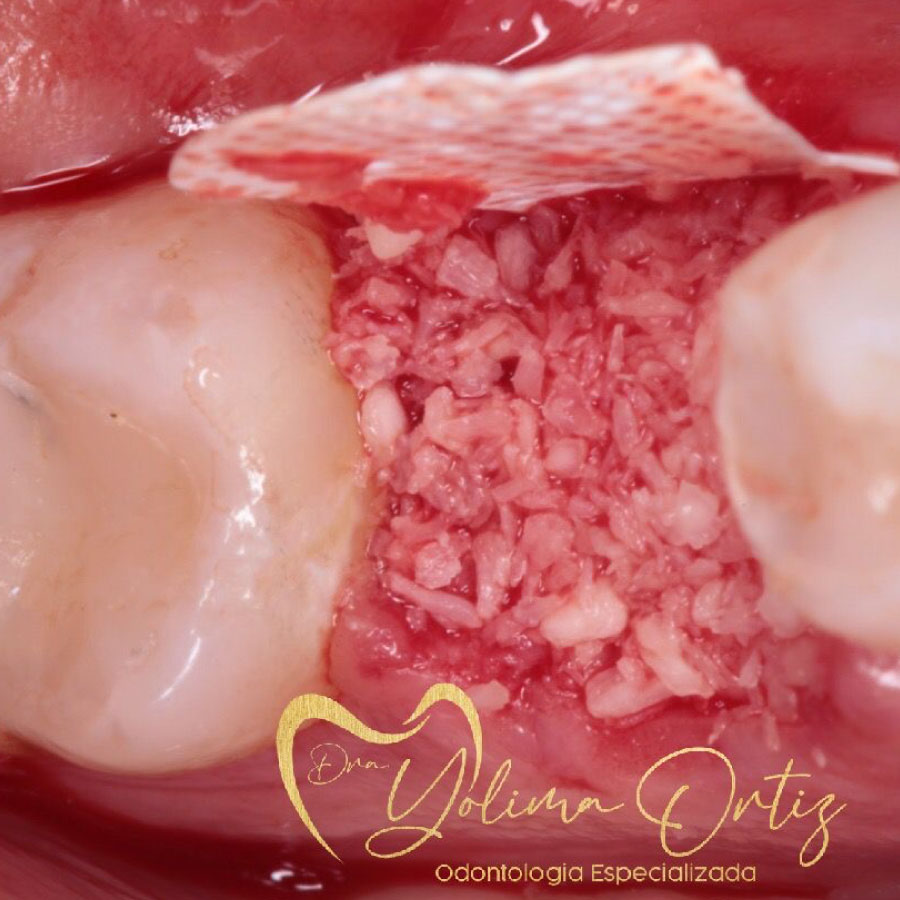periodoncia e implantología oral
