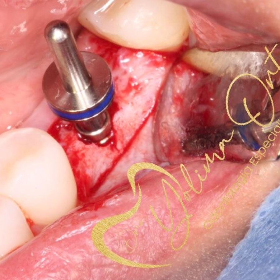periodoncia e implantología oral
