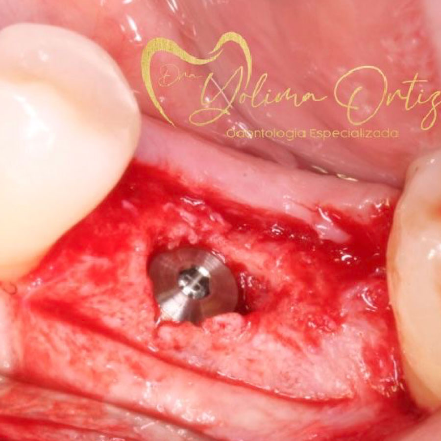 periodoncia e implantología oral