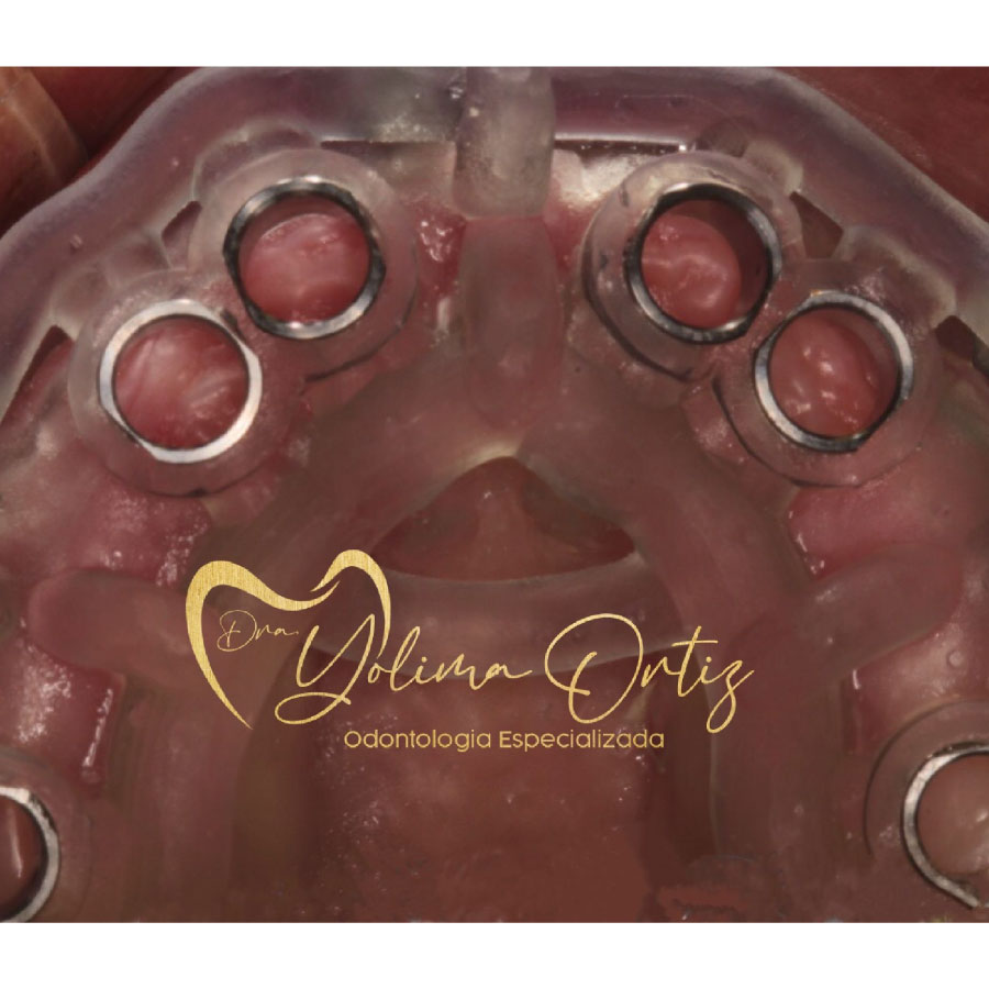 periodoncia e implantología oral