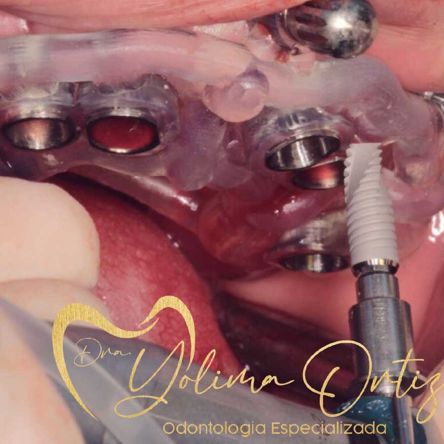 periodoncia e implantología oral