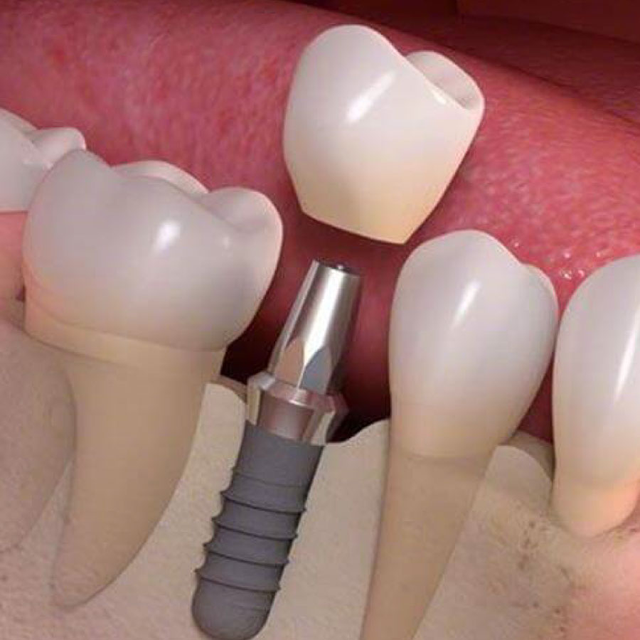 periodoncia e implantología oral
