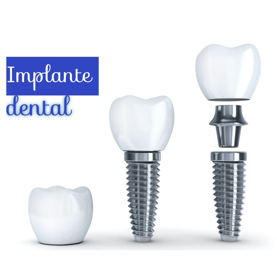 periodoncia e implantología oral