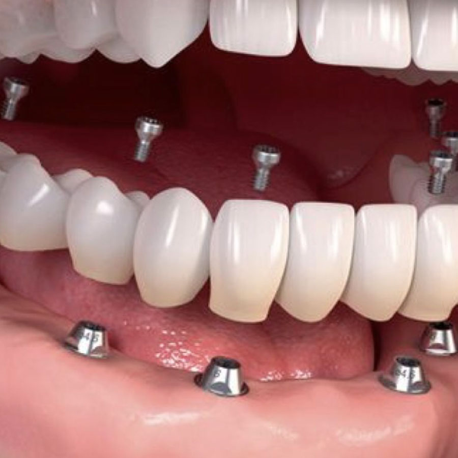 periodoncia e implantología oral