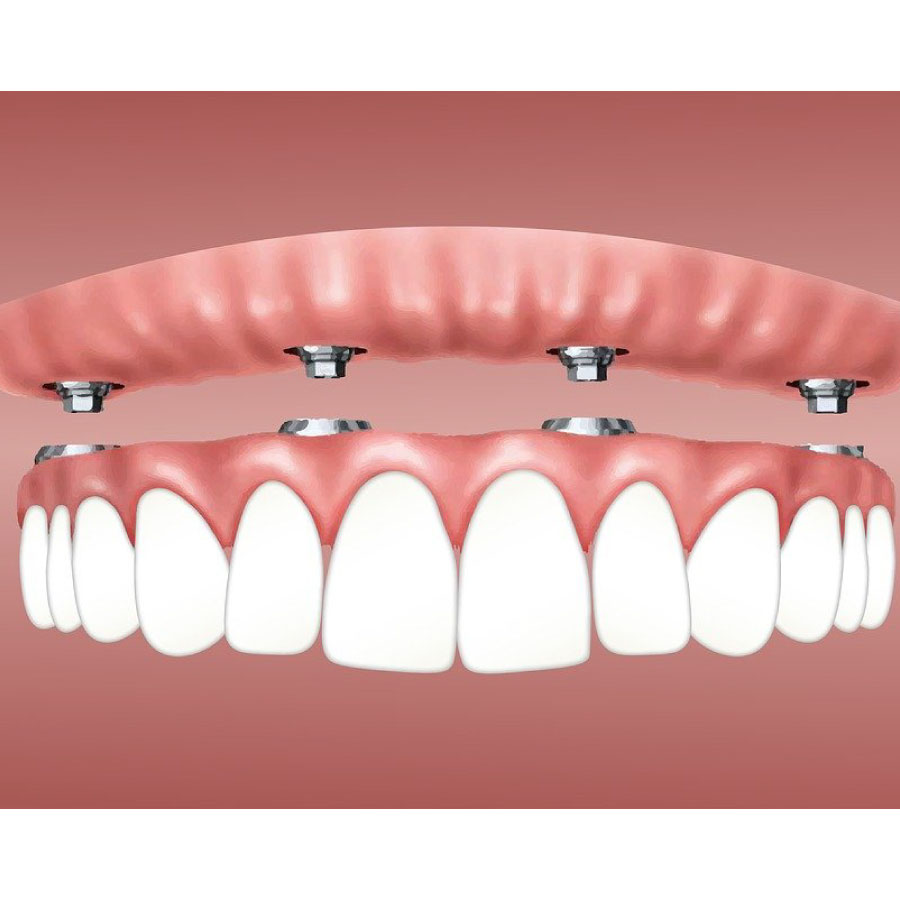 periodoncia e implantología oral
