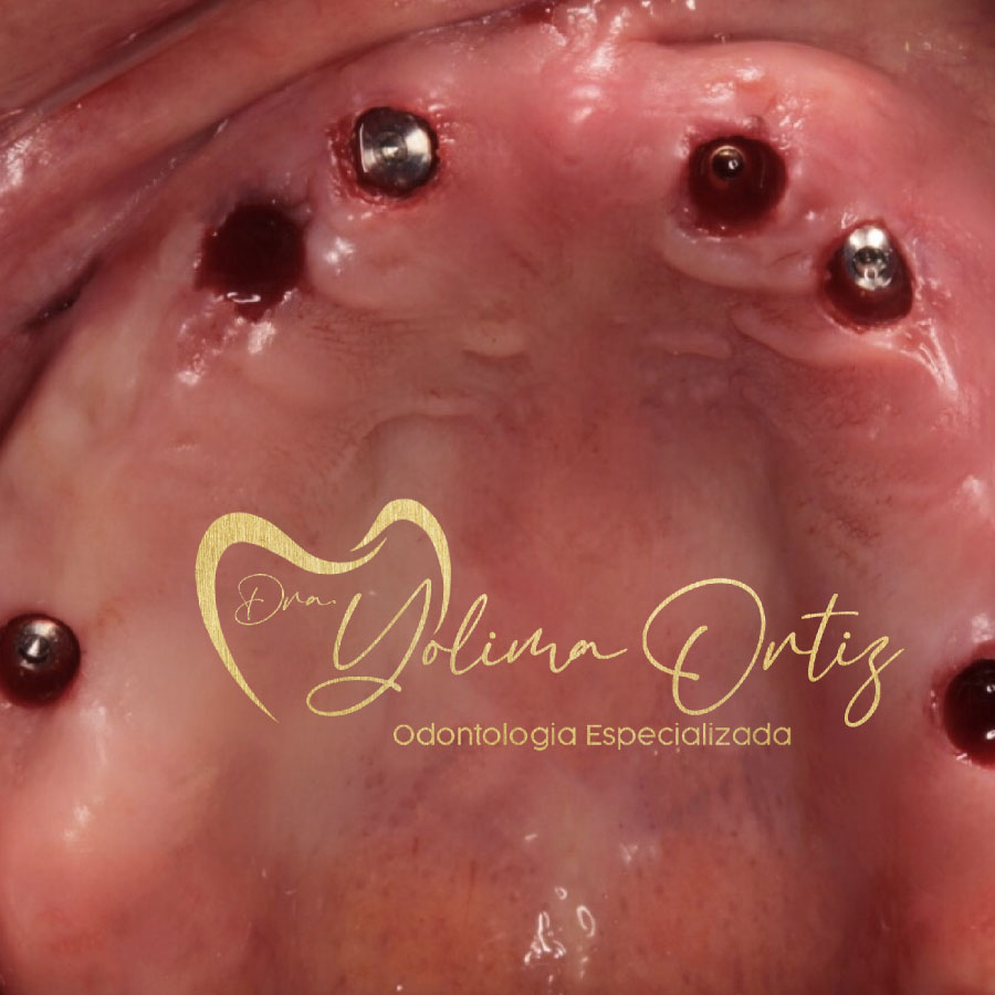 PERIODONCIA E IMPLANTOLOGÍA ORAL