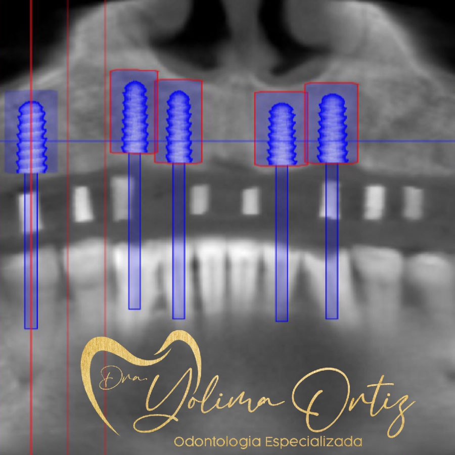 PERIODONCIA E IMPLANTOLOGÍA ORAL
