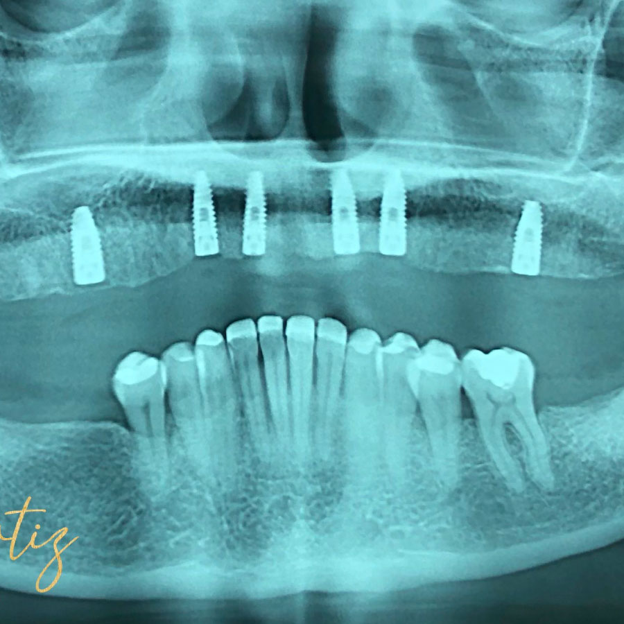 PERIODONCIA E IMPLANTOLOGÍA ORAL